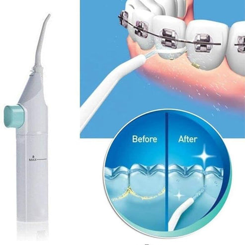 Dental Water Flosser